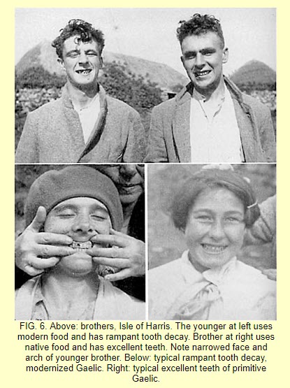 Gaelic men NPD Weston PRice Gaelic men NPD Weston PRice