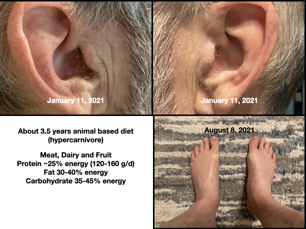 Ears and feet on hypercarnivore diet 